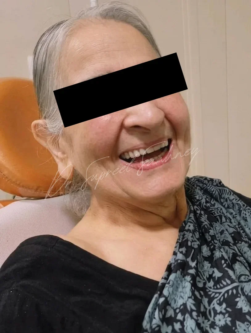 Patient smiling after denture insertion, with eyes obscured for privacy